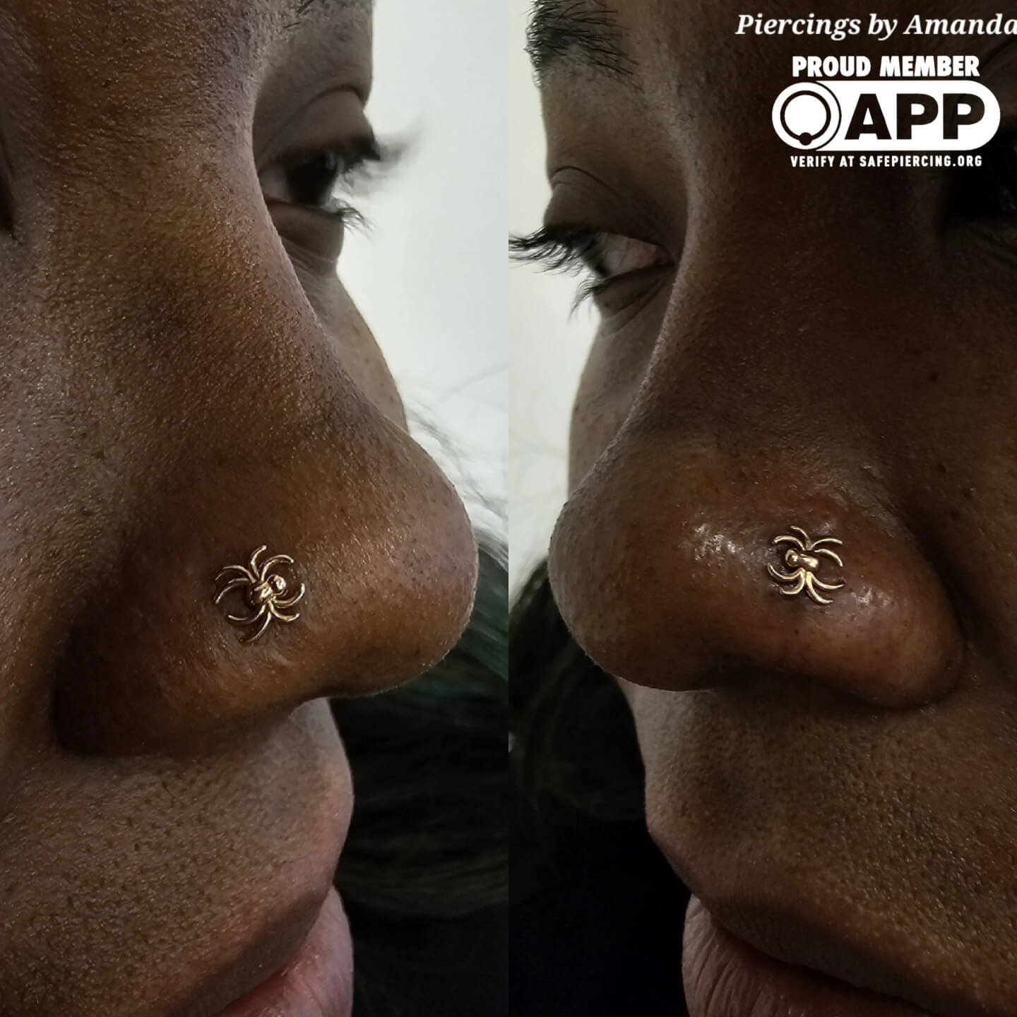 One healed and one fresh nostril piercings with gold spider